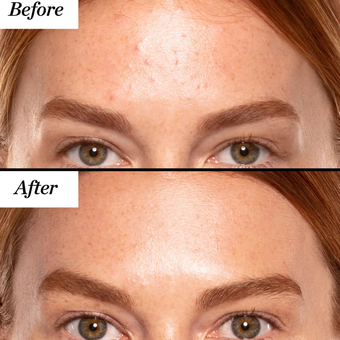 A+ High-Dose Retinoid Serum 30ml