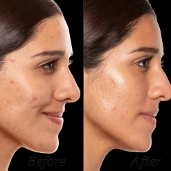 A+ High-Dose Retinoid Serum 30ml