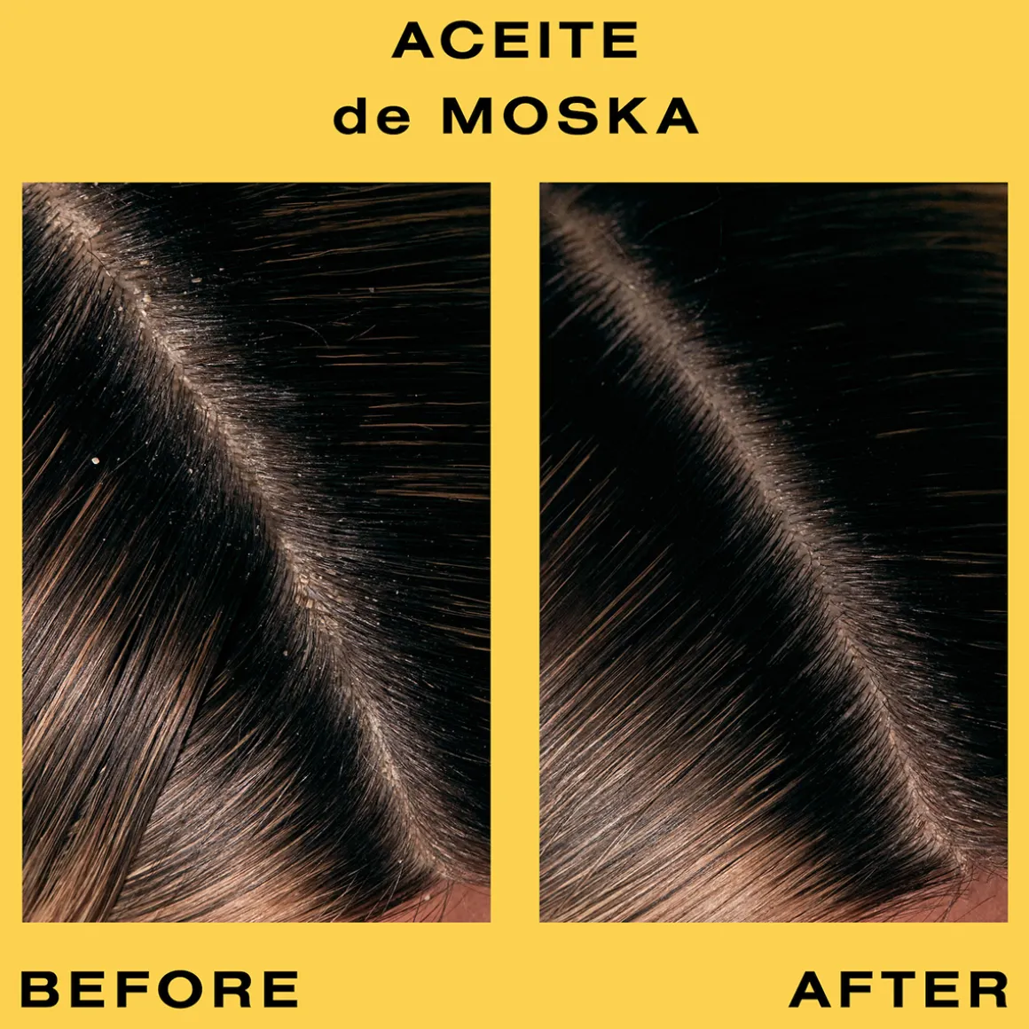 Aceite de Moska Scalp Oil 60ml