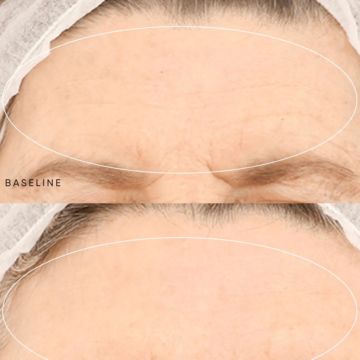 Night Renewal Travel Kit