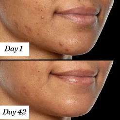 U.F.O. Ultra Clarifying Treatment Face Oil 35ml